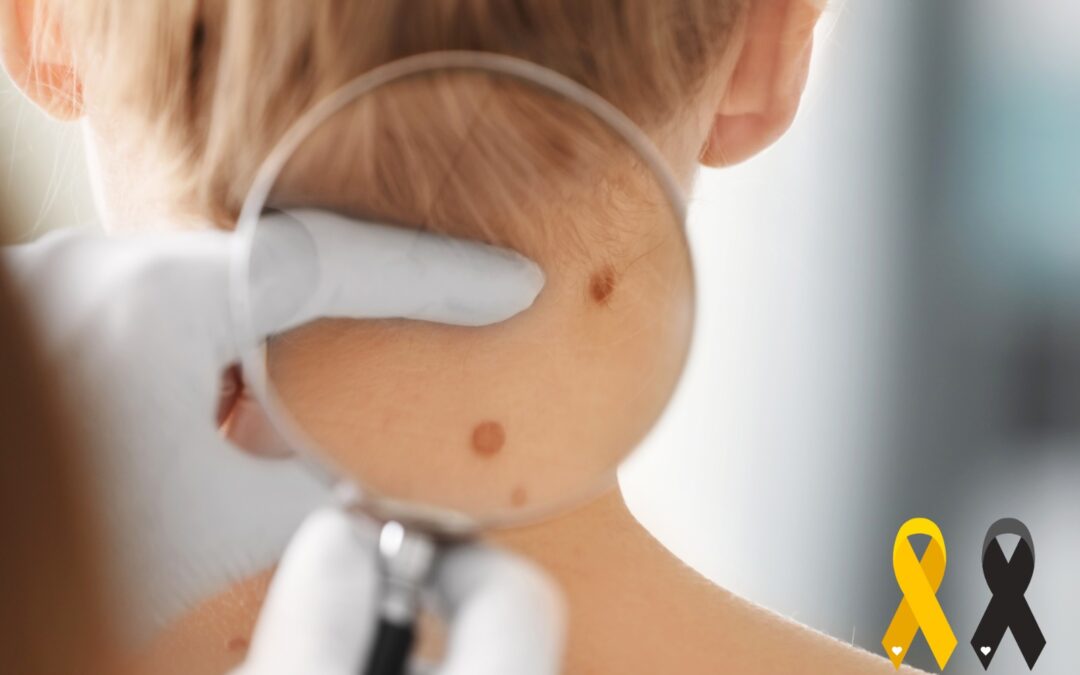 Melanoma negli adolescenti e giovani